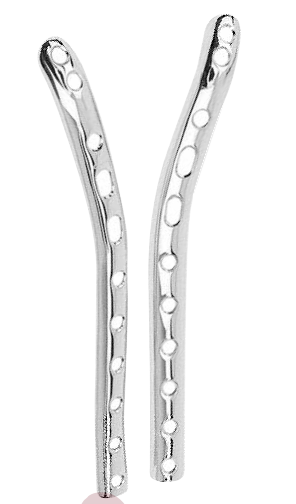Epicondylar Plate 3.5 mm