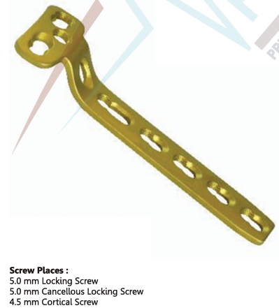 'T' – Buttress locking Plate