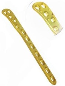 Lateral Tibia Buttress Locking Plates 6.5mm (Right)